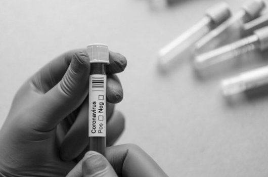 Händer som håller ett coronatest